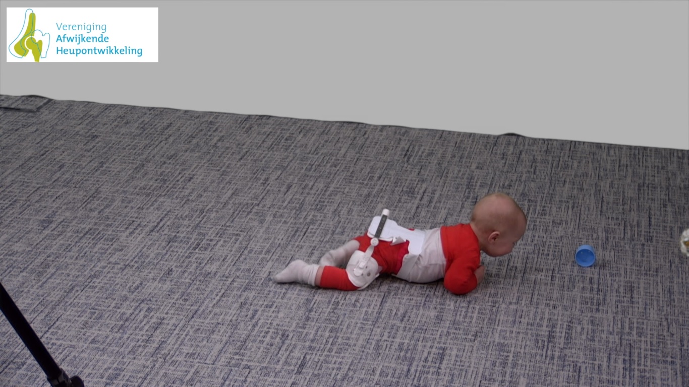 Dr. Visserspreidbeugel